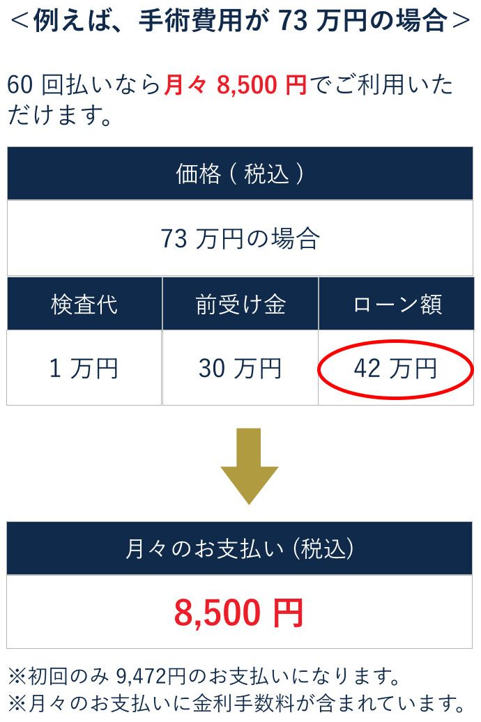 ICL手術73万円の場合の60回払いの分割価格表